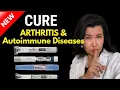 What Ozempic Mounjaro Zepbound Actually Do to Arthritis and Autoimmune Diseases