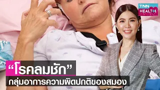การรักษาโรคลมชักมีวิธีใดบ้าง และต้องทานยาตลอดชีวิตหรือไม่