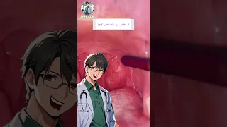 ما هي حصوات اللوزتين وأسبابها حصوات اللوزتين رائحة الفم Shorts التهاب اللوزتين نصائح طبية 