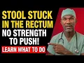 Stool STUCK in the Rectum What is it and what to do Doctor Explains