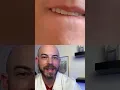 Derm reacts to the most DISGUSTING pimple pop ever