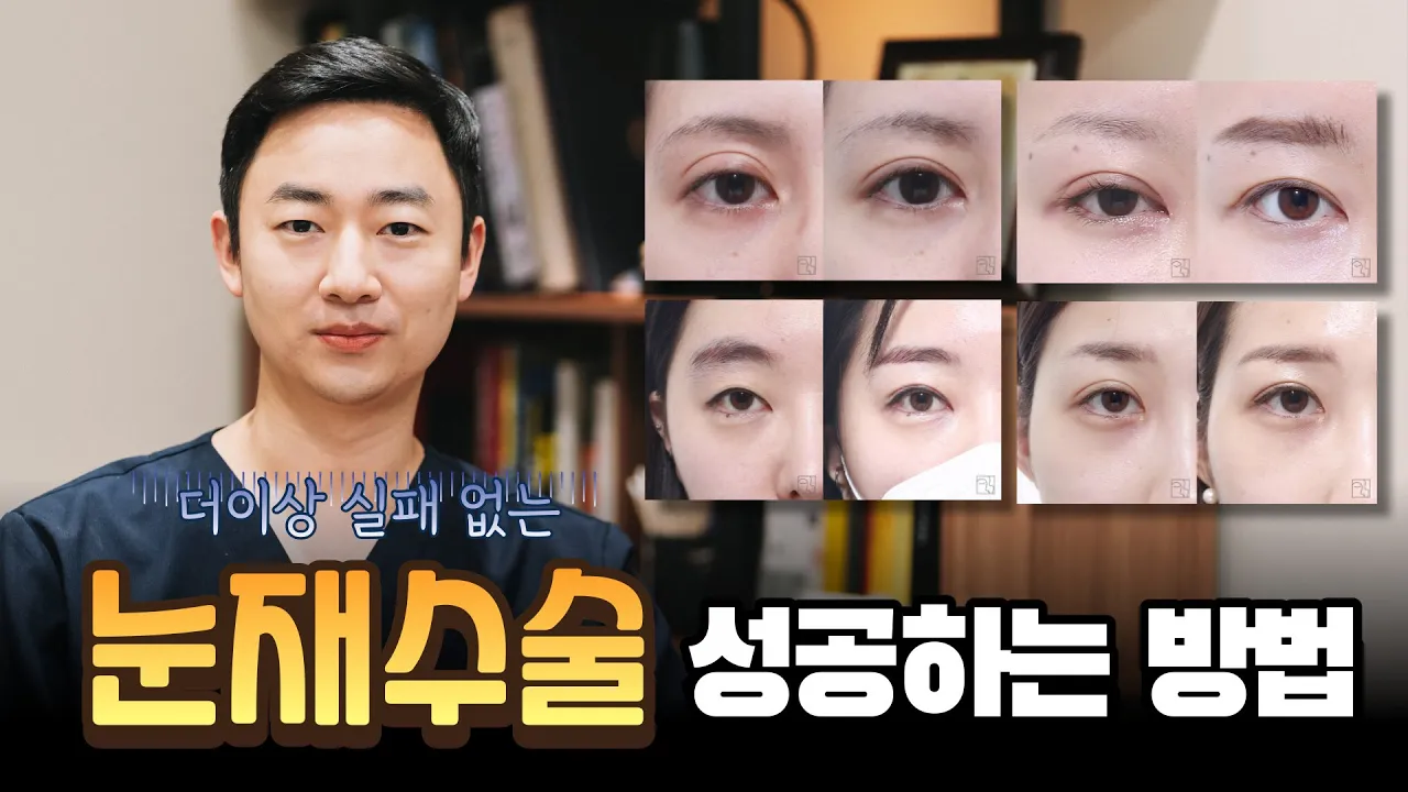 눈재수술 성공할 수 있을까? 😨