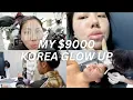 I SPENT 9000 ON MY GLOW UP IN KOREA EVERYTHING I GOT DONE PRICES PAIN LEVEL RECOVERY