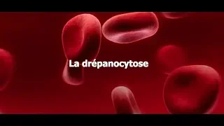 La drépanocytose au CHR de Liège : témoignages de patients (sous-titres NL)