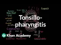 Tonsillopharyngitis - Complications diagnosis and treatment NCLEX-RN Khan Academy