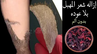 The Herb That Gets Rid Of Excess Hair From The Roots Without Pain And Forget The Imitation Methods 