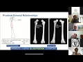Download Lagu Husky Orthopaedics. Trauma Case Discussion  Multi Insitution collaboration