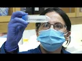 SPUTUM PROCESSING