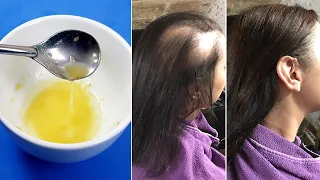 Masques Anti-Perte De Cheveux | Appliqué Sur Vos Cheveux, Les Cheveux Poussent Vite et Naturellement