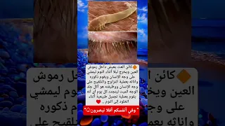 معلومه أول مرة أسمع بها عن كائن العث الذي يعيش داخل رموش العين ويخرج أثناء النوم 