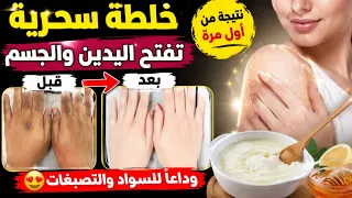 ضعيها ليلة قبل النوم ‼️واقسم بالله ‼️في الصباح النتيجة ستبهرك ‼️بشرة بيضاء كالحليب ‼️بدون مكياج
