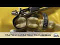 Matrix in matrix technique