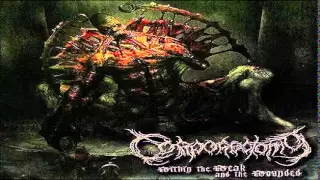 Download Corporectomy - Within the Weak and the Wounded (FULL EP // 2008) MP3