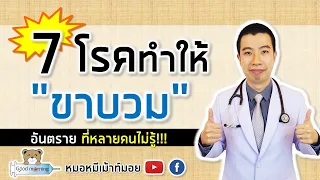 อาการบวมที่ขาสองข้างร่วมกับอาการอื่นๆ อาจบ่งบอกถึงโรคใดบ้าง