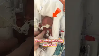 They Miraculously Survived Shorts 