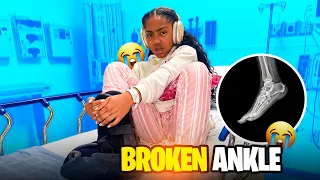 I BROKE MY ANKLE