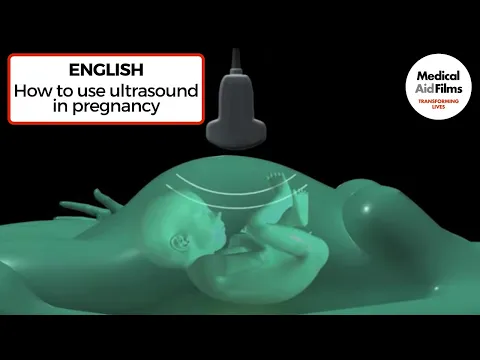 Download MP3 How to use ultrasound in pregnancy