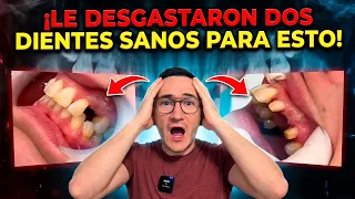 ¡Le desgastaron DOS DIENTES SANOS para esto! Puente dental de circonia