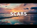 Lagu DJ Funkynight! - Scars - Keenan Te ( Awan Axello Remix )