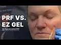 How are PRF and EZ Gel Different