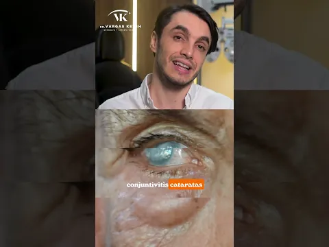 ¿Es bueno o peligroso usar miel en los ojos? 🐝