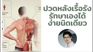 การรักษาอาการปวดหลังจากออฟฟิศซินโดรมสามารถทำได้อย่างไรบ้าง