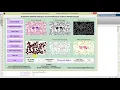 Matlab Code for Malaria Detection and Classification in Blood Images Full Source Code