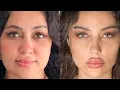 extreme facial sculpting and snatching procedure experimental 1x MAX