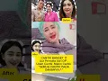 Lagu UUT PERMATA SARI OPLAS, UDAH CANTIK MAKIN CANTIK #uutpermatasari #viral #oplas