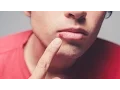 Dermatologist explains causes of cold sores
