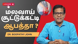 are you suffering from anal abscess here is the solution dr boopathy john je nesam hospitals