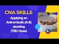 CNA Skills Applying Ted Hose with testing checkpoints