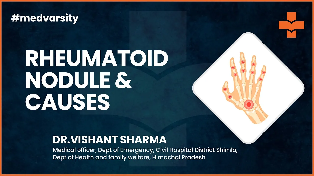 Case Discussion on Rheumatoid Nodule and Causes