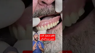 طقم أسنان متحر ك ثابت دندنها