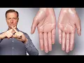 How to Stop Excessive Sweating Hyperhidrosis