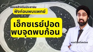 หากพบก้อนในปอด แพทย์จะใช้วิธีใดในการประเมินความเสี่ยงต่อการเป็นมะเร็ง