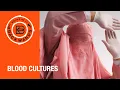 Download Lagu Interview with Blood Cultures