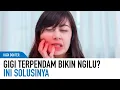 Download Lagu Gigi Terpendam Bikin Ngilu? Yuk Kupas Tuntas Permasalahan Gigi dan Mulut! | Kata Dokter