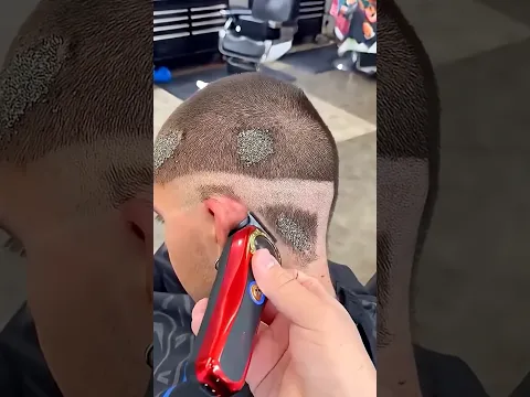 El barbero vio miles de huevos en su cabeza… 😱