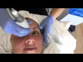 HydraFacial Experience