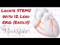 Locate and interpret STEMI based on 12 Lead EKG