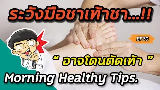 ควรทำอย่างไรเมื่อมีอาการมือชาเท้าชาจากโรคเบาหวาน