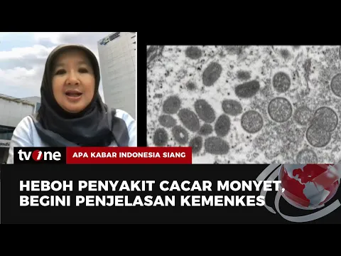 Waspada Cacar Monyet Masuk Indonesia, 88 Kasus Terkonfirmasi