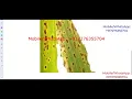 Rice Plant Disease Detection Using Image Processing Python Project With Source Code Rice LeafDisease