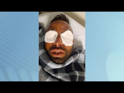 Corpo de bombeiros alerta sobre cuidados e riscos com fogos de artifício