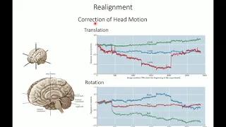 fMRI data preprocessing II