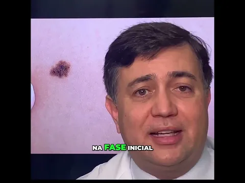 Identifique sinais precoces de melanoma #shorts