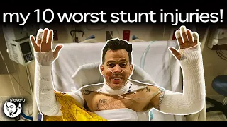 My Ten Worst Stunt Injuries | Steve-O
