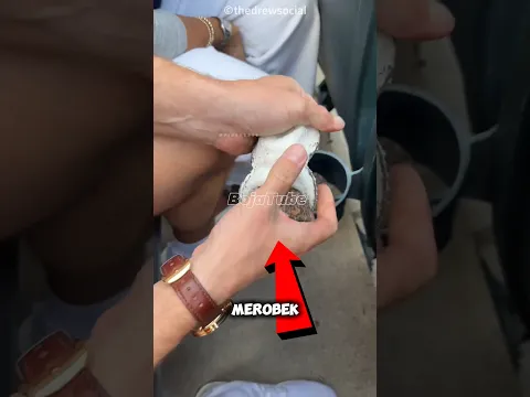 “Pria Ini Merobek Bola Foul yang Baru Ditangkap, Ternyata Ini Alasannya! 😱⚾” #shorts