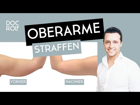 Download MP3 OBERARME STRAFFEN VORHER/NACHHER- Dr. Rolf Bartsch